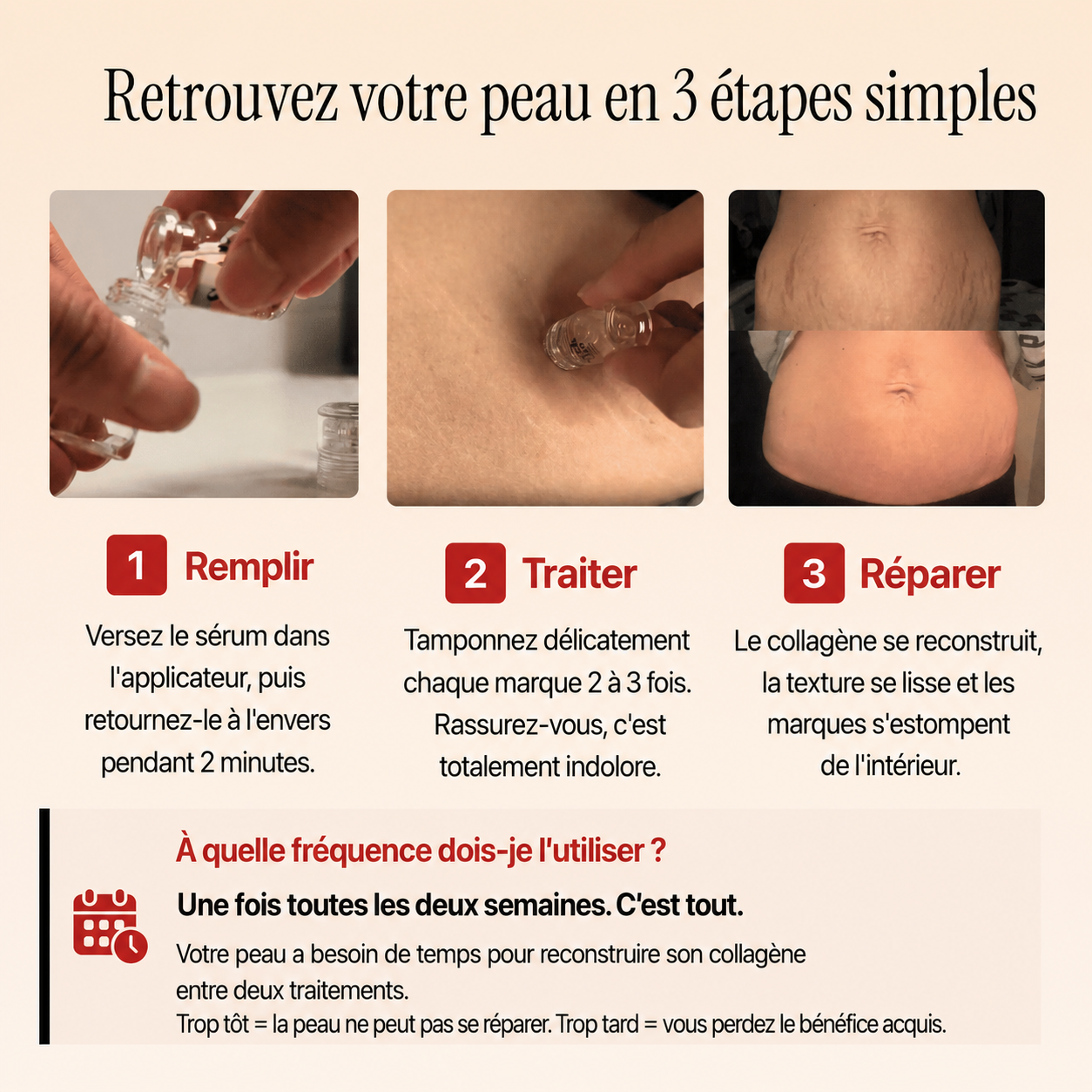 Rénéclat ™
