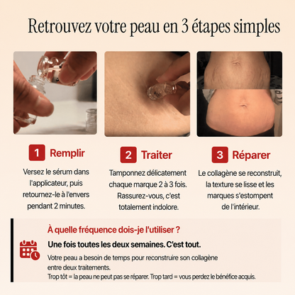 Rénéclat ™