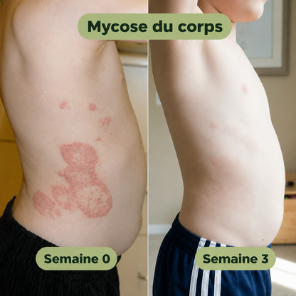 Écorce Pure™