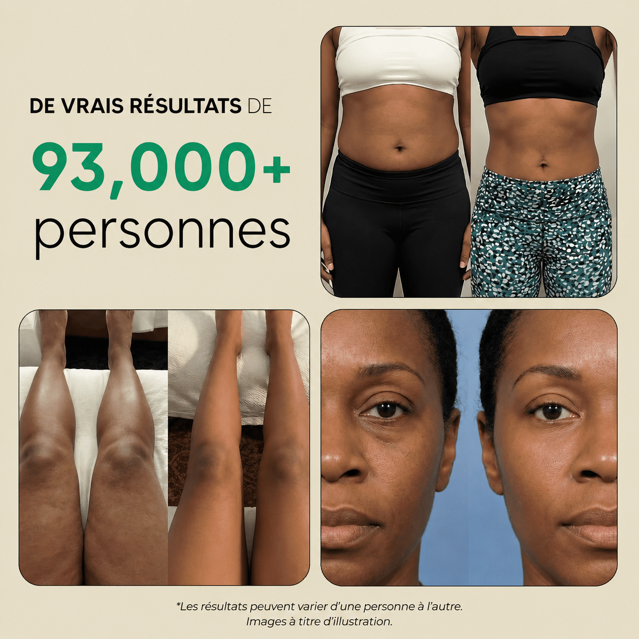 Rénalys ™