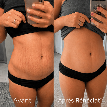 Rénéclat ™