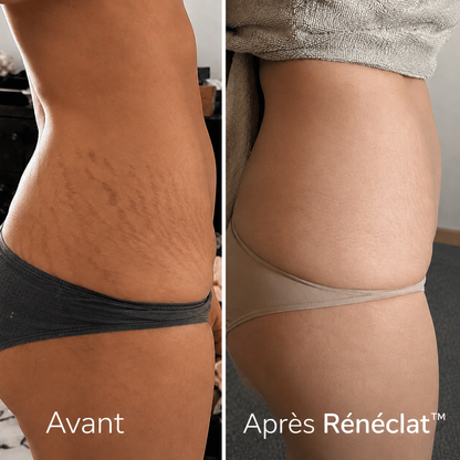 Rénéclat ™