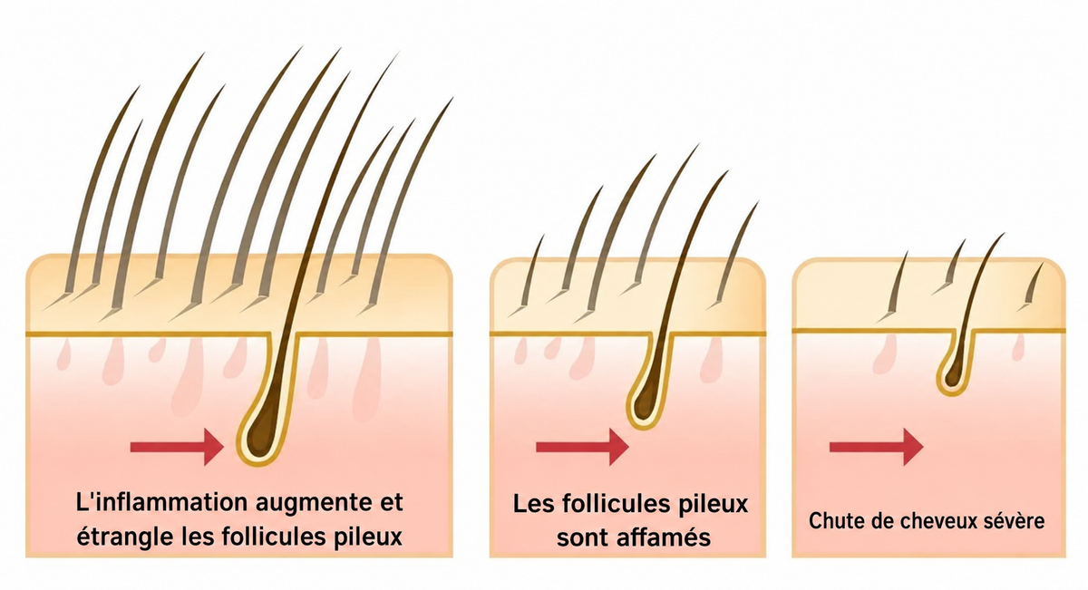 L'inflammation étrangle les follicules pileux — Folivé™