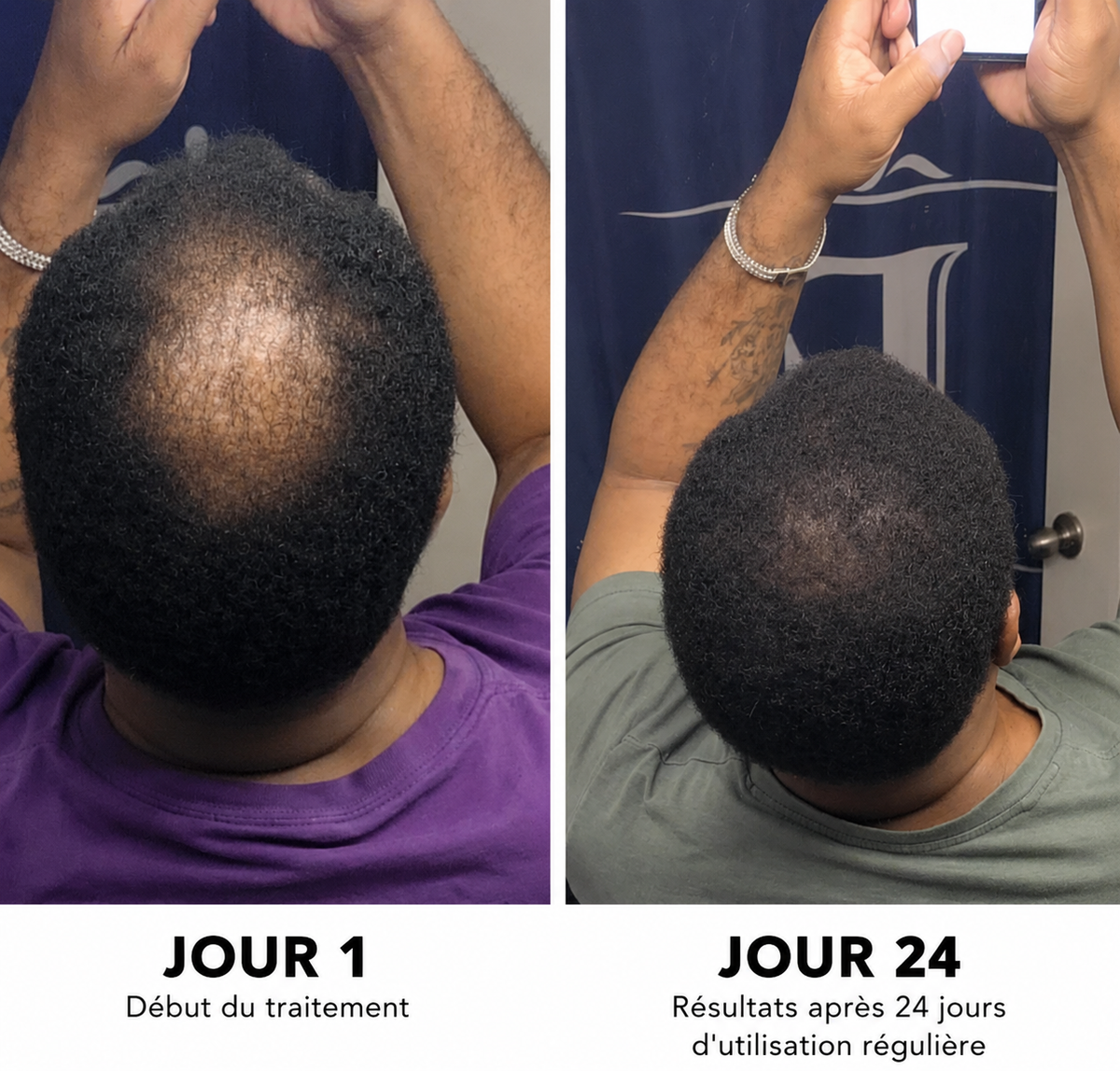 Résultats Folivé™ : jour 1 et jour 24
