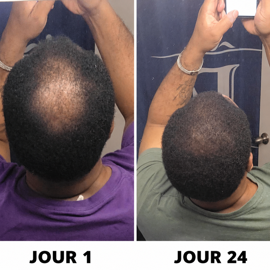 Résultat Folivé™