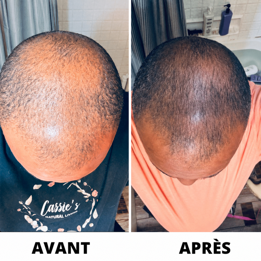 Résultat Folivé™