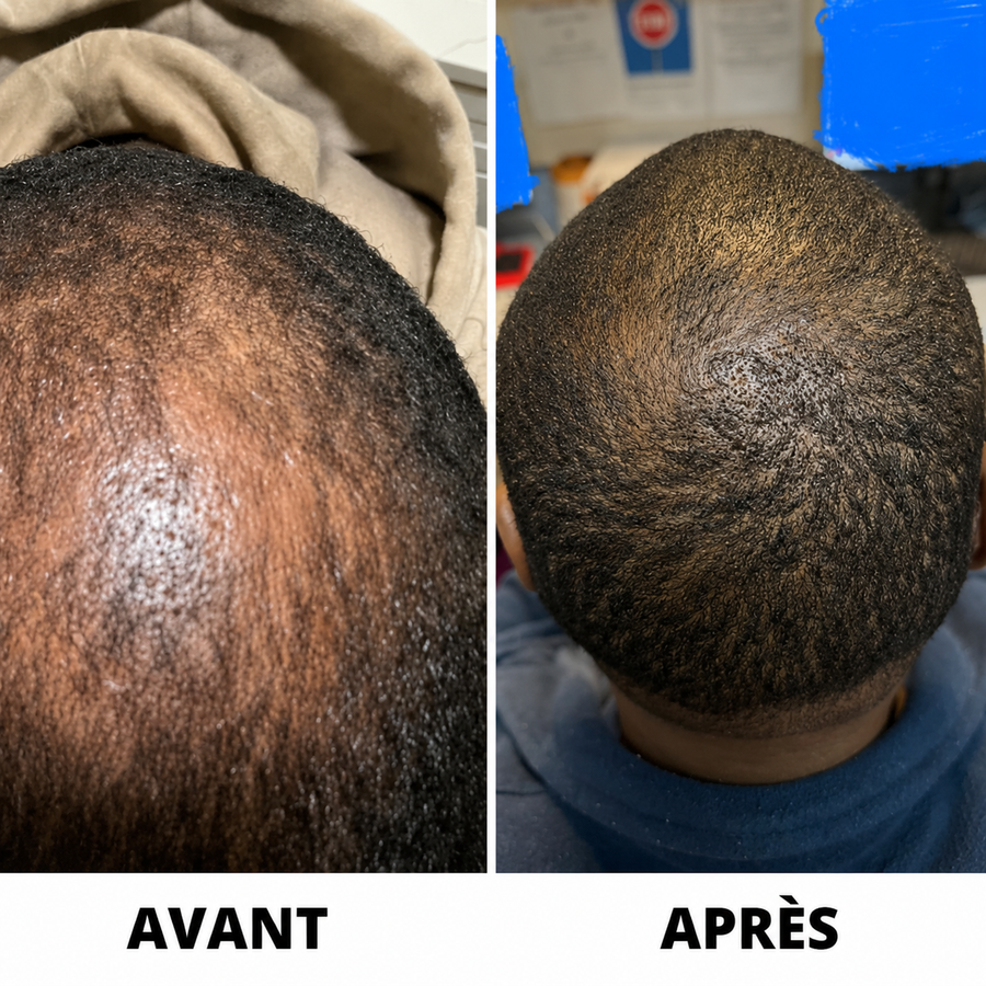 Résultat Folivé™