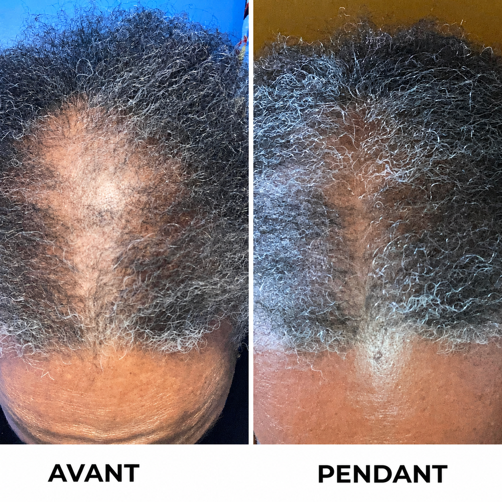 Folivé™