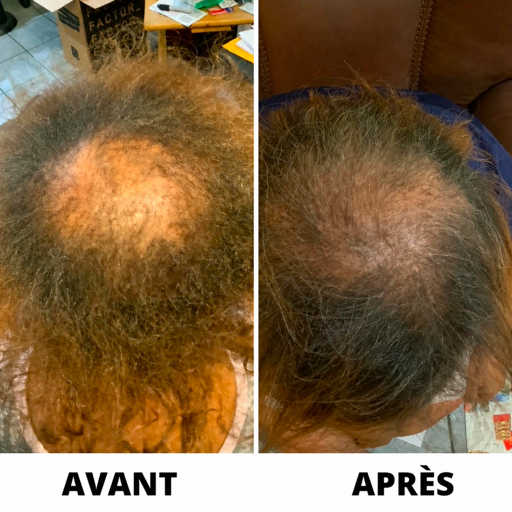 Folivé™