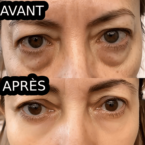 Avant / Après