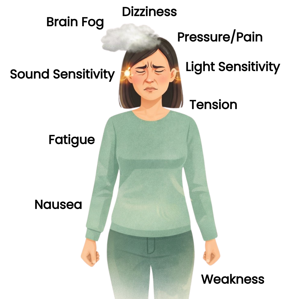 Femme montrant les zones touchées par la migraine